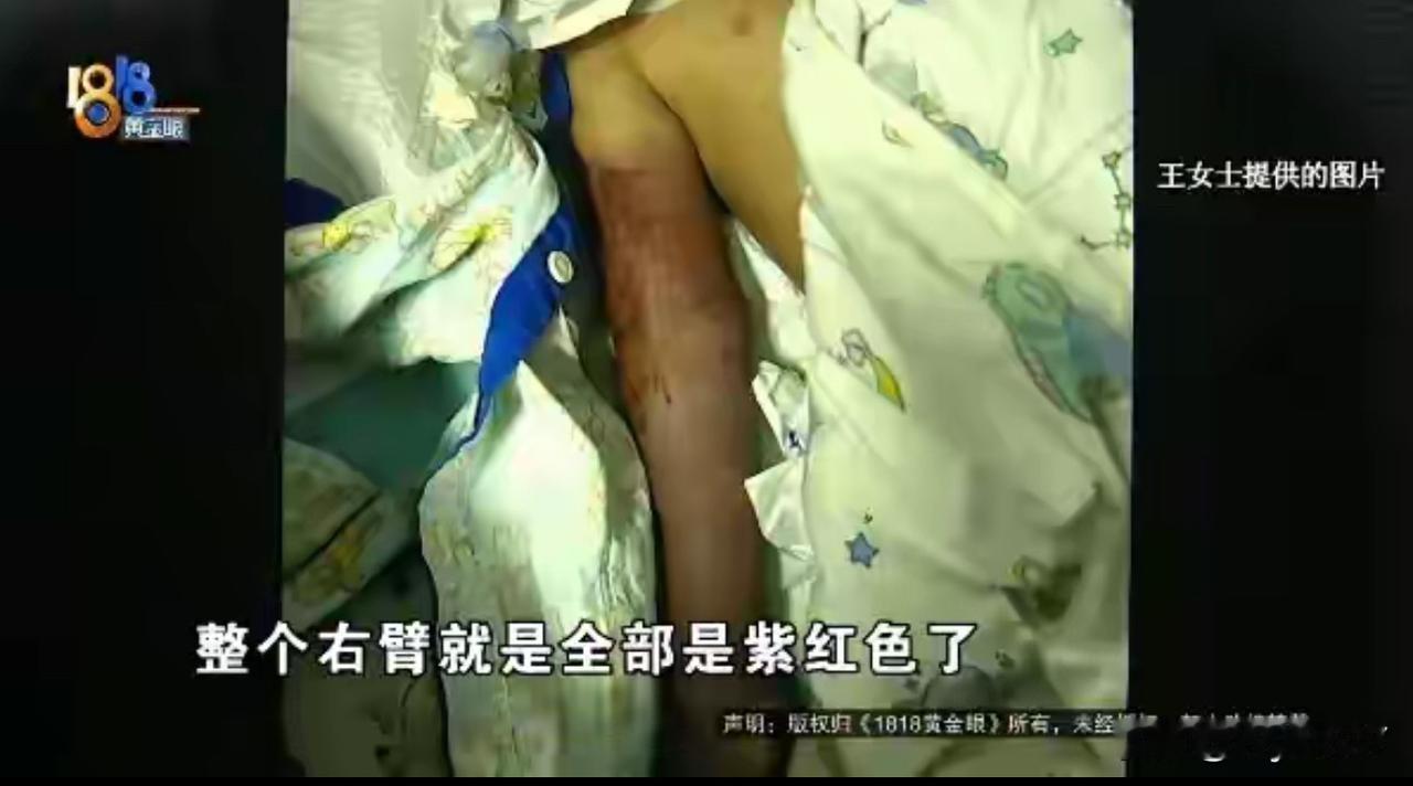**盛夏泳池藏隐患排水口吸人悲剧再敲警钟**上海6岁男孩意外死亡，在酒店游