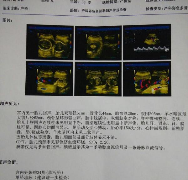 为什么我的宝宝是单脐动脉? 你叫我如何舍得不要她?