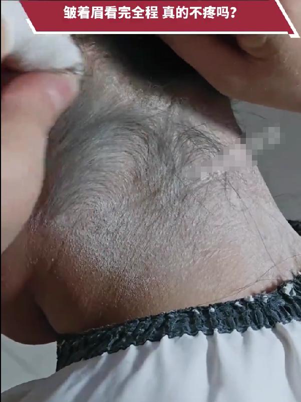 新娘出嫁徒手拔光碎发：指尖翻飞太生猛，网友看得龇牙咧嘴最近宁夏一场婚礼上，新娘