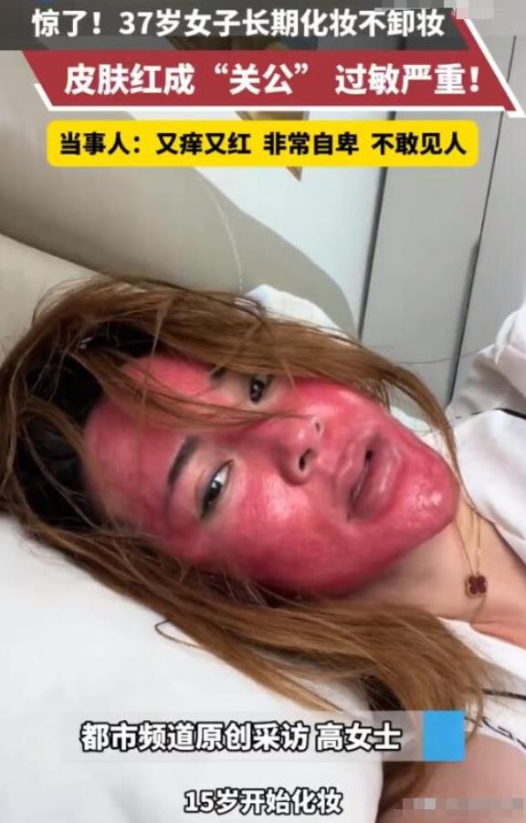 6月18日，吉林37岁女子从15岁开始化妆，就没有卸过妆。好不容易勤奋一次，心血