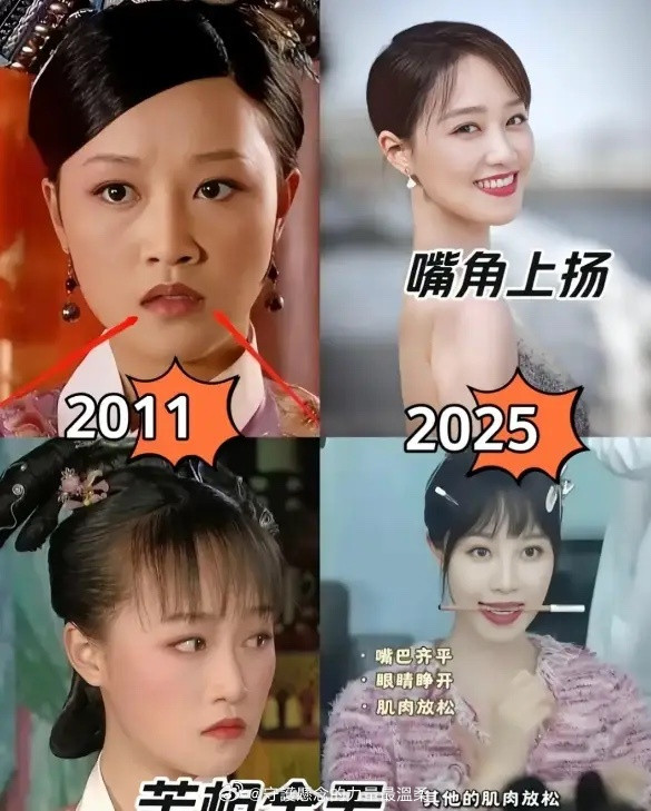 蓝盈莹的苦相脸改变我以为是整容了，没想到竟然靠咬筷子6年，硬生生掰回来了！