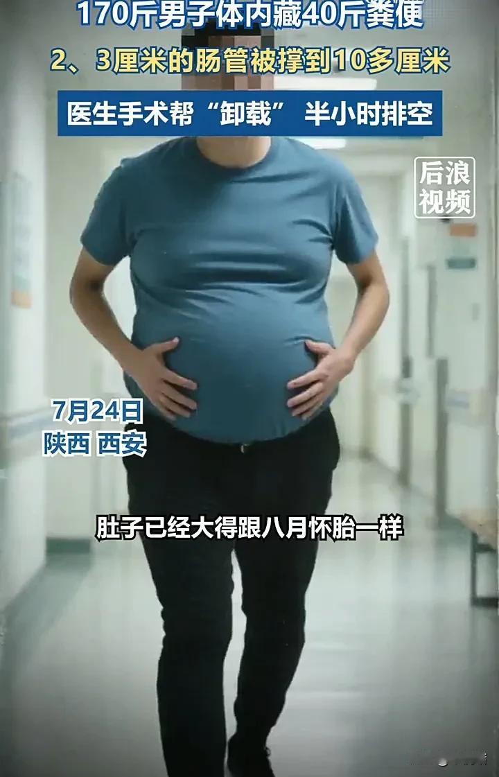 看完直接震惊了！7月24日，陕西西安一名男子一个月没有正常上厕所，导致肚子大得像