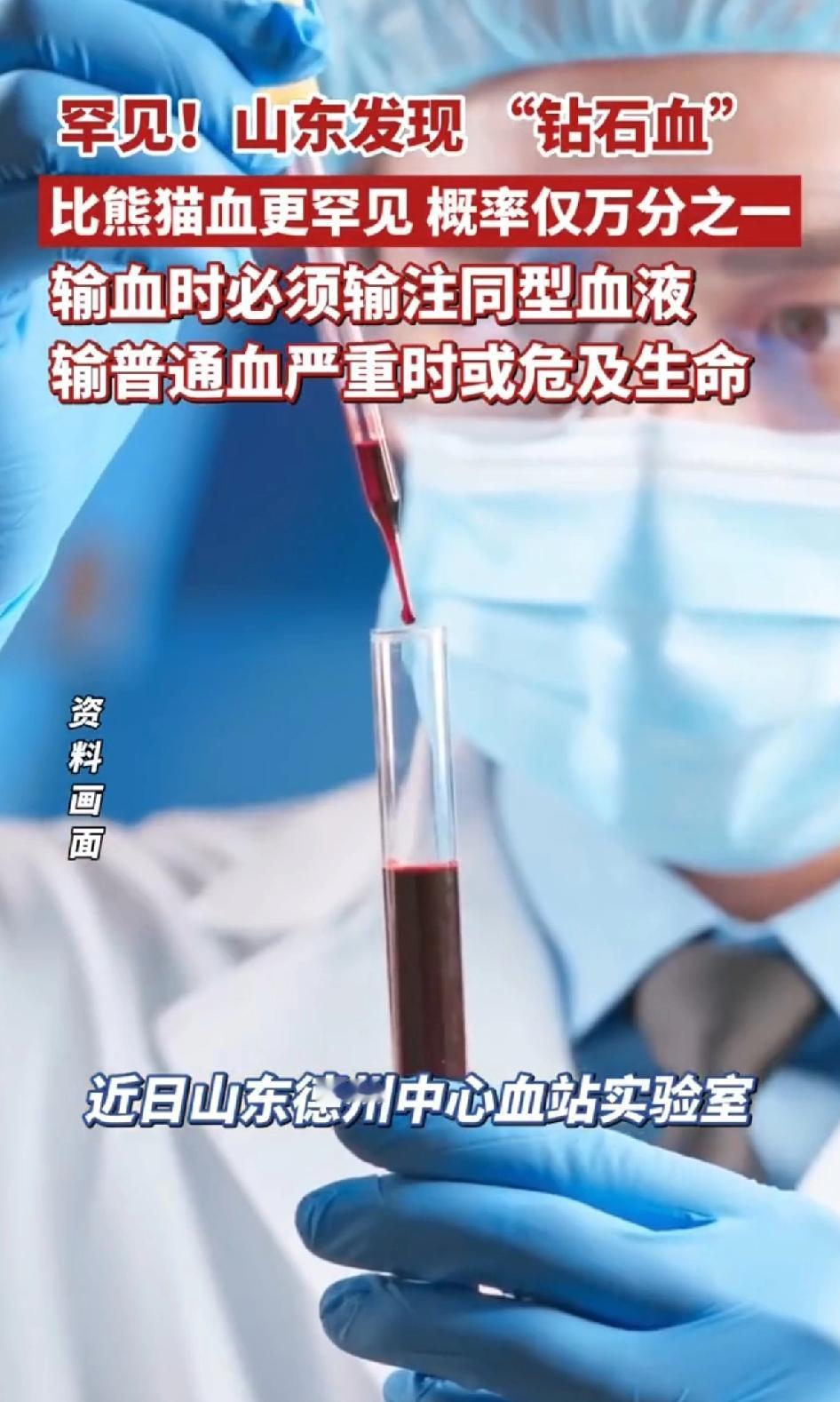 罕见！山东发现“钻石血”，比熊猫血更罕见，概率仅万分之一。山东德州中心血站在课