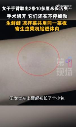 “真的看完浑身发麻！”广东深圳，一名女子手臂长出莫名包块，拖延近一年，疼到无法抬