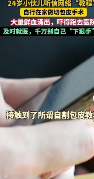 上海，一24岁小伙，因包皮过长反复感染，不好意思去医院，竟信了网上“自割教程”。