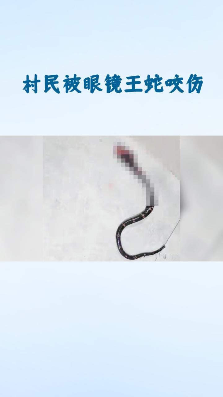 眼镜王蛇一口，竟需13支血清救命？近日，云南省昭通市鲁甸县梭山镇一名村民在田间