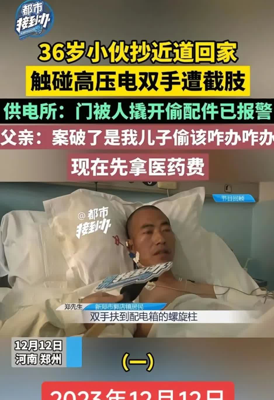 这可真是个十足的“人才”啊！两年前，他由于偷窃高压电配件，被电伤后双手被截肢