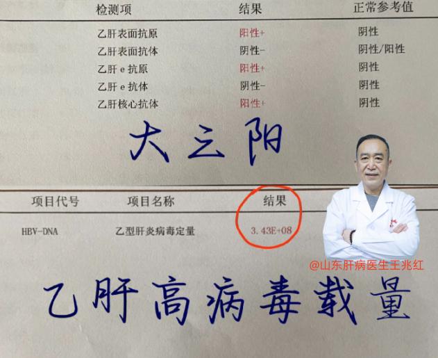 乙肝大三阳放任不治会怎么样？乙肝大三阳若不及时干预，一般后果很严重.1.病毒