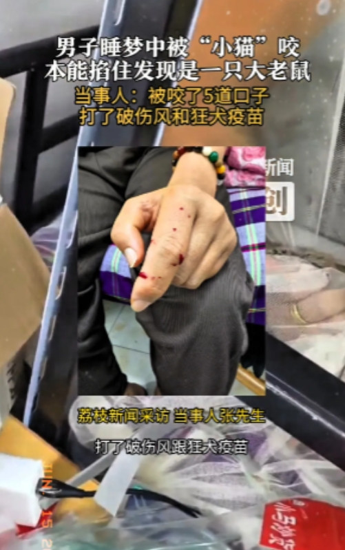 6月14日，江苏无锡一名男子张先生睡梦中感觉手上有东西爬动，以为是自家猫咪，顺手