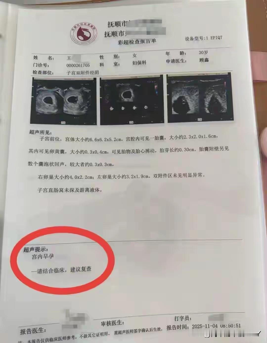 辽宁抚顺，一位30岁女子自然受孕后去医院产检，结果却发现，每一次产检胎儿都会多一