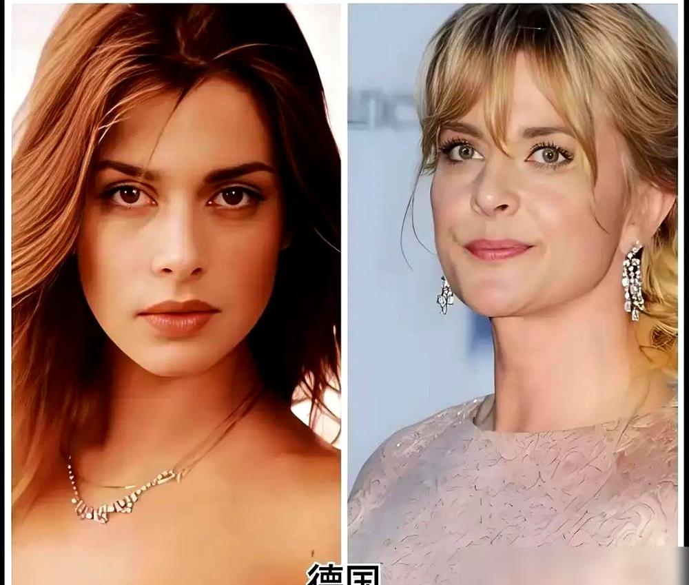 东亚人抗老真的是天生有优势，不是瞎吹。皮肤科多项研究实锤，咱们真皮层比白人厚