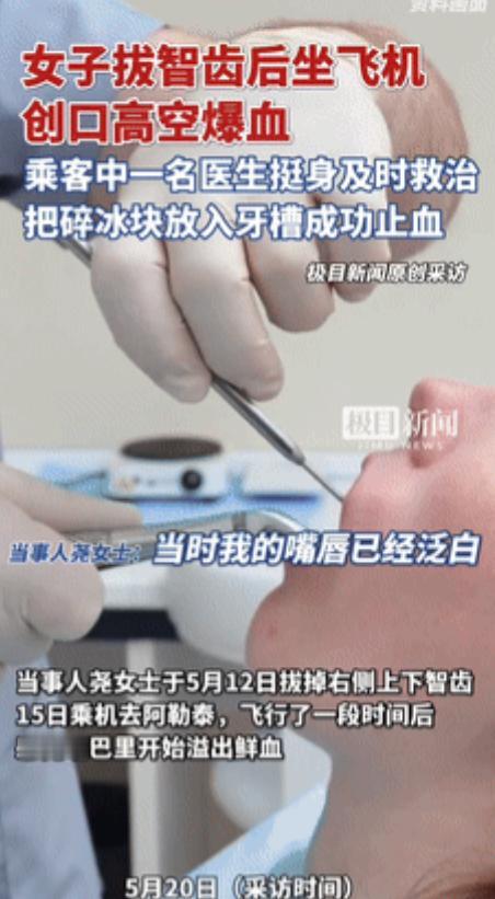 “怪不得飞行员不能有伤疤！”女子拔智齿仅3天后坐飞机，伤口竟在高空爆开，因失血过
