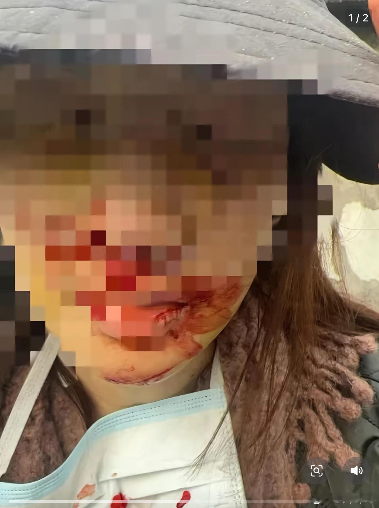 警方通报金晨事件金晨助理顶包或被拘留罚款1.首先肯定是助理替金晨顶包，毋庸置疑，