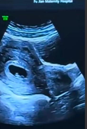 气哭了，女子二婚，未婚先孕，未怀孕之前，婆家说下彩礼18万，买三金，结果先怀孕了