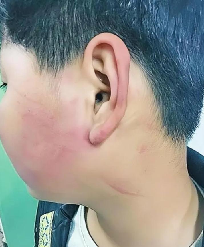 四川一学校校长，因被学生挑衅，于是扇了学生两巴掌，事后校长被孩子母亲逼着赔礼道歉