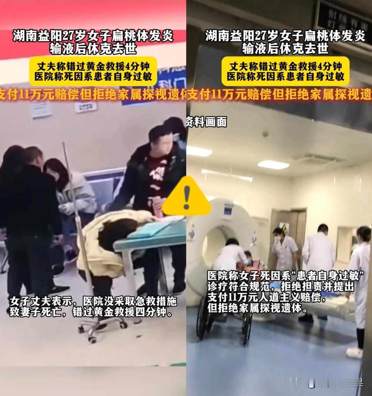 27岁妈妈只是扁桃体发炎，去医院输液，头孢刚滴进去4秒，立刻出现严重过敏反应！丈