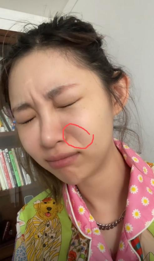 痞幼不满法令纹，大方承认医美，声称不是因为焦虑？近日，顶流网红痞幼因在短视频