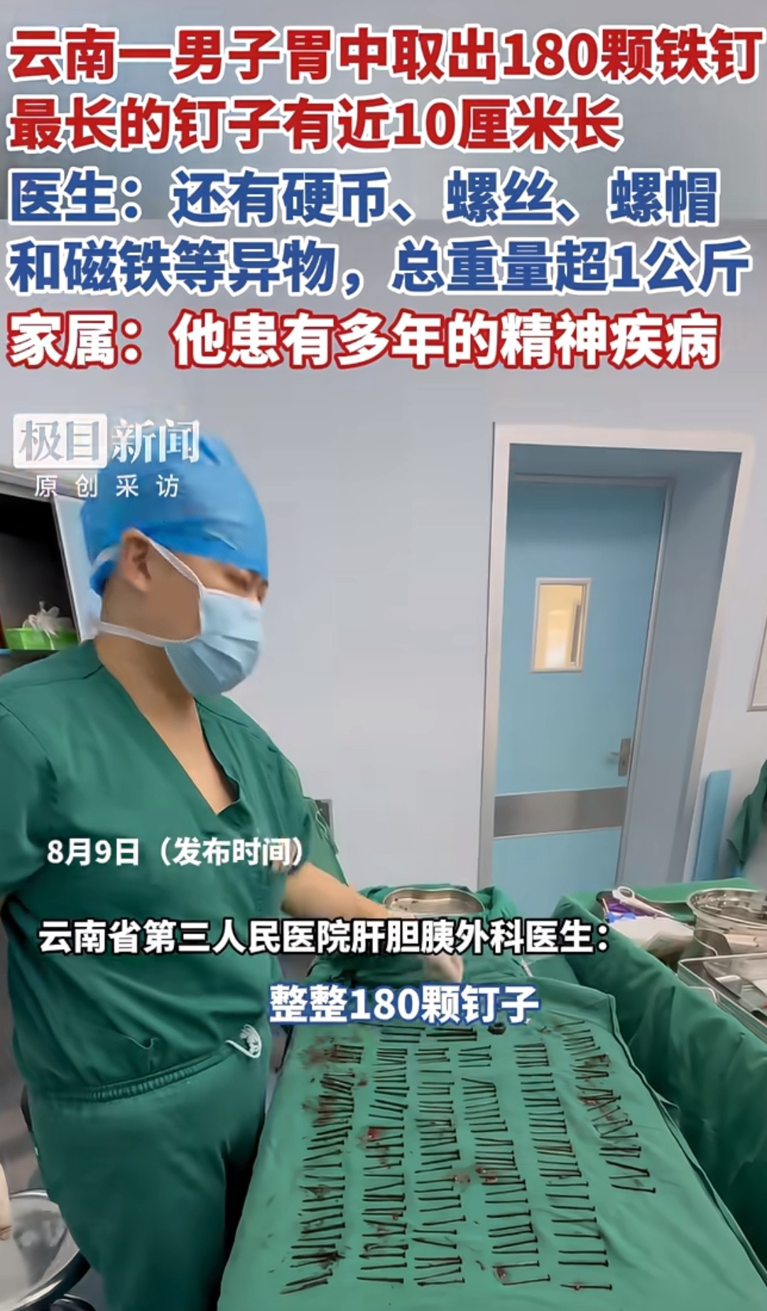 云南一男子胃中取出180颗铁钉这个胃也是很厉害了