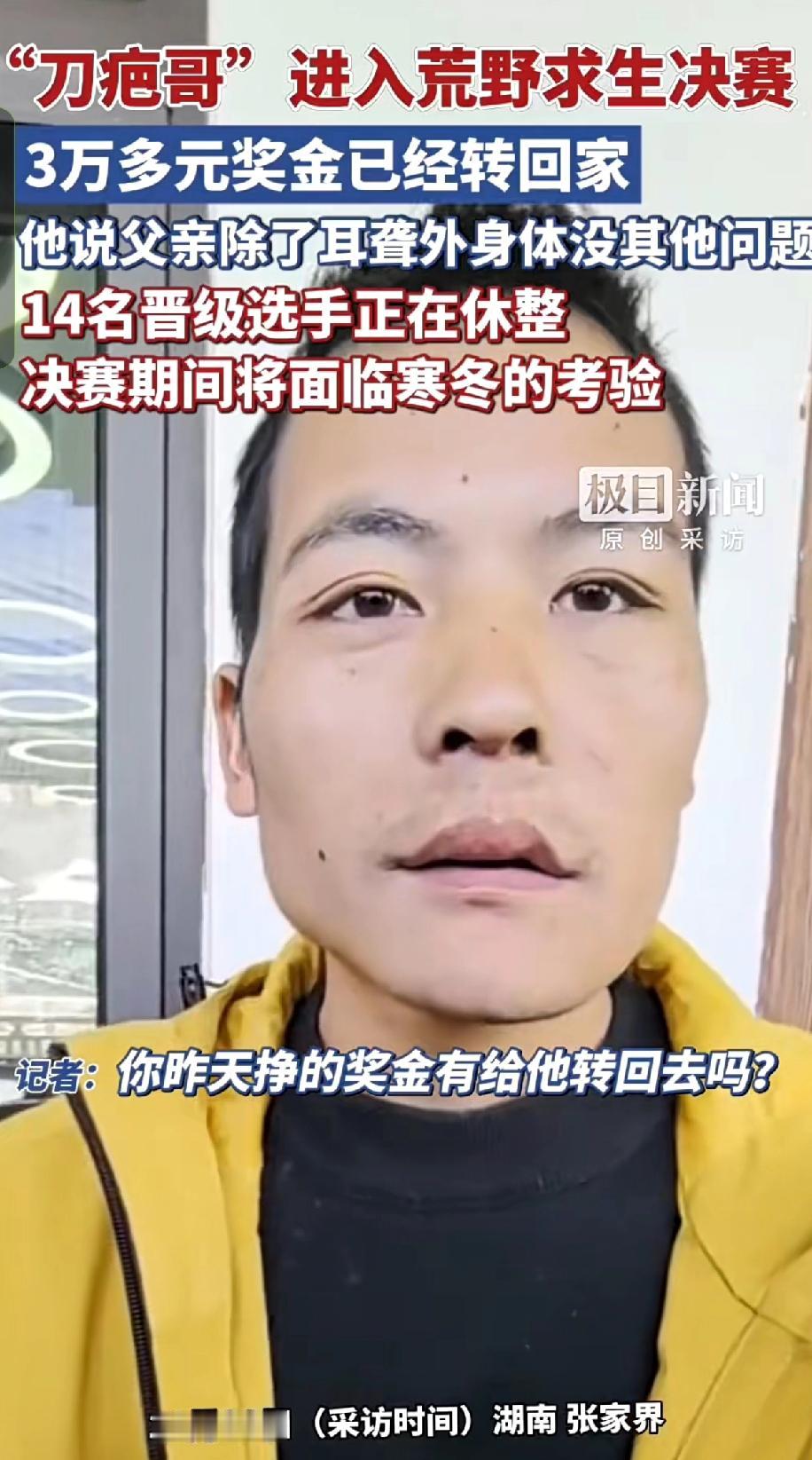 励志！“刀疤哥”闯到荒野求生决赛，3万奖金先转回家：“爸，等我拿冠军给你买新助听