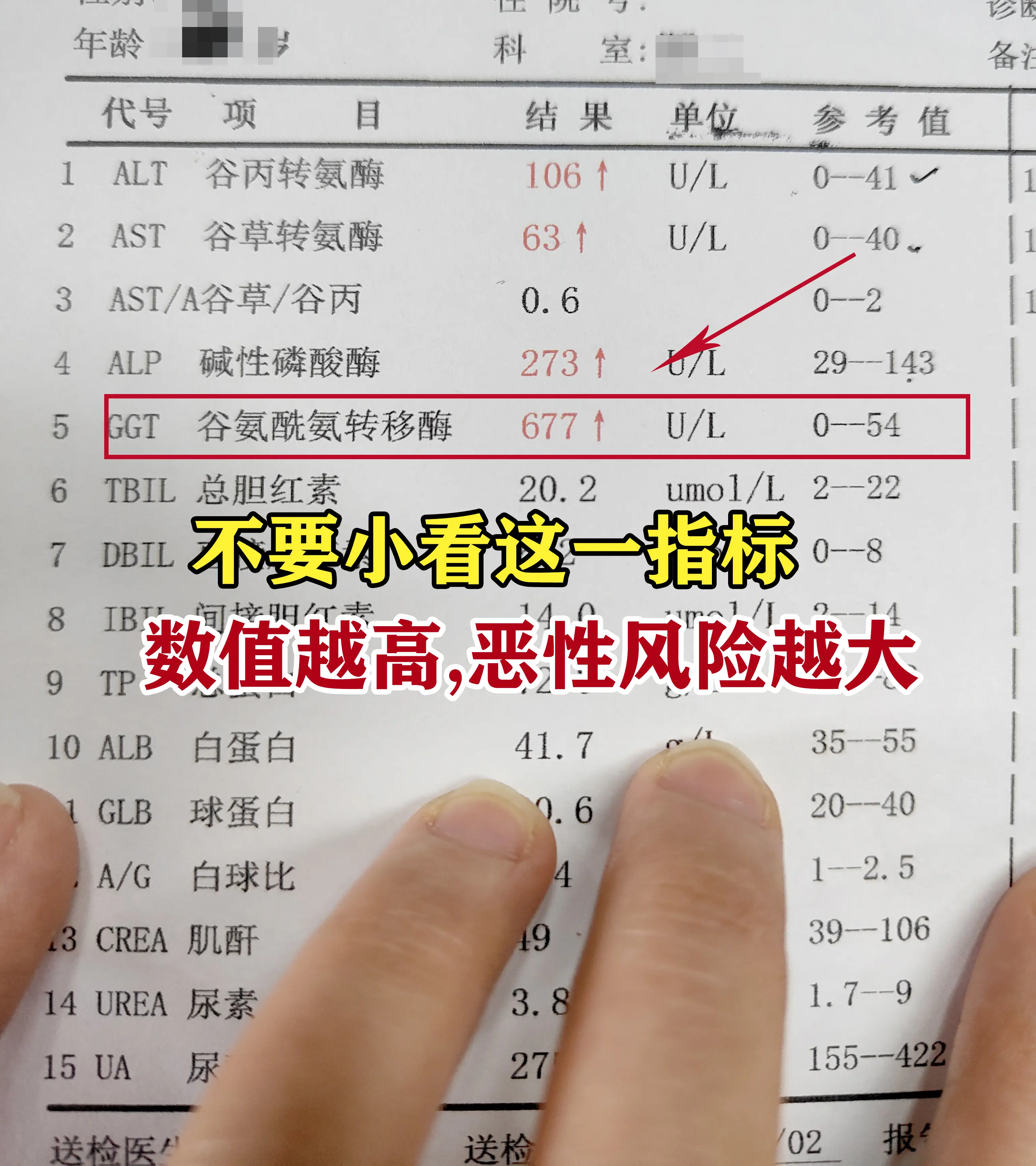 日常复查时，很多人只把谷氨酰氨基转移酶当成判断饮酒、脂肪肝、胆道问题的...
