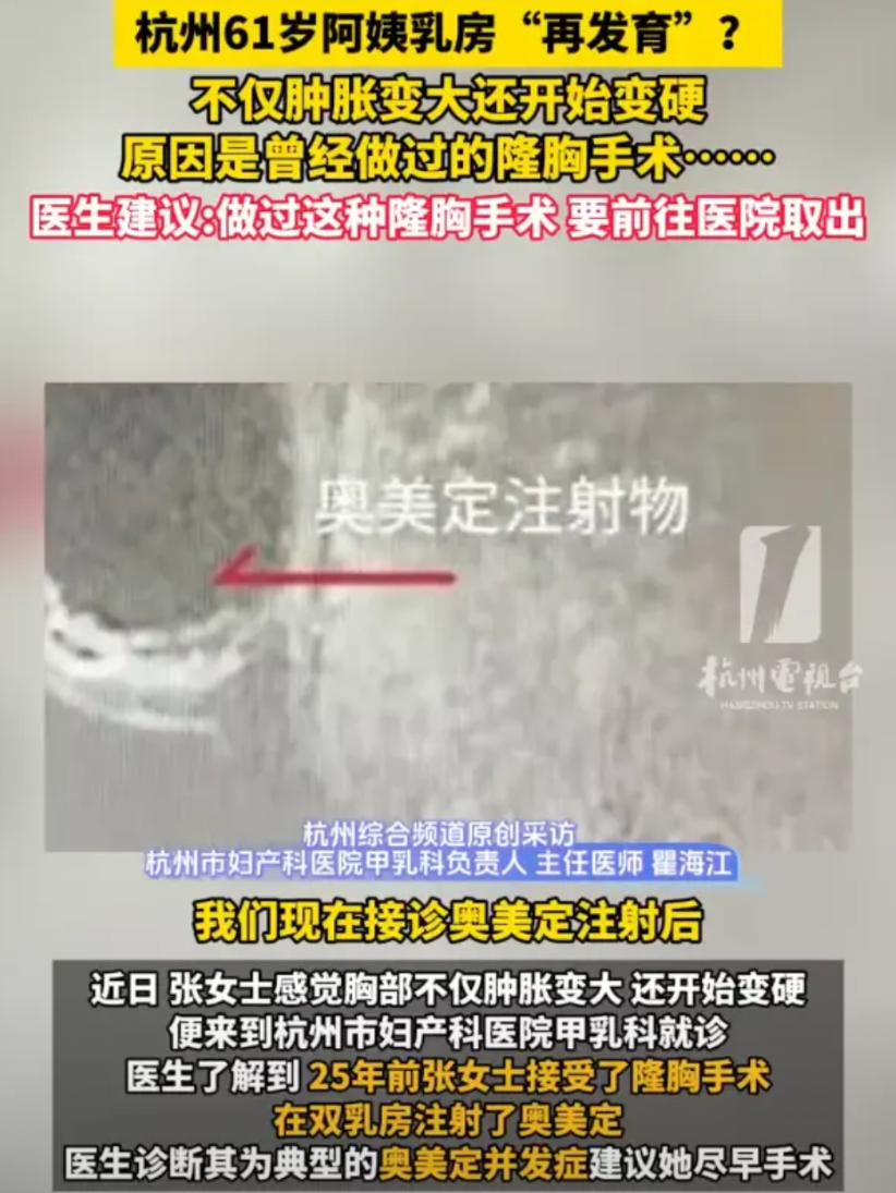差点解释不清了！浙江杭州，61岁女子洗澡时，突然发现自己的胸部似乎变大了，但这个