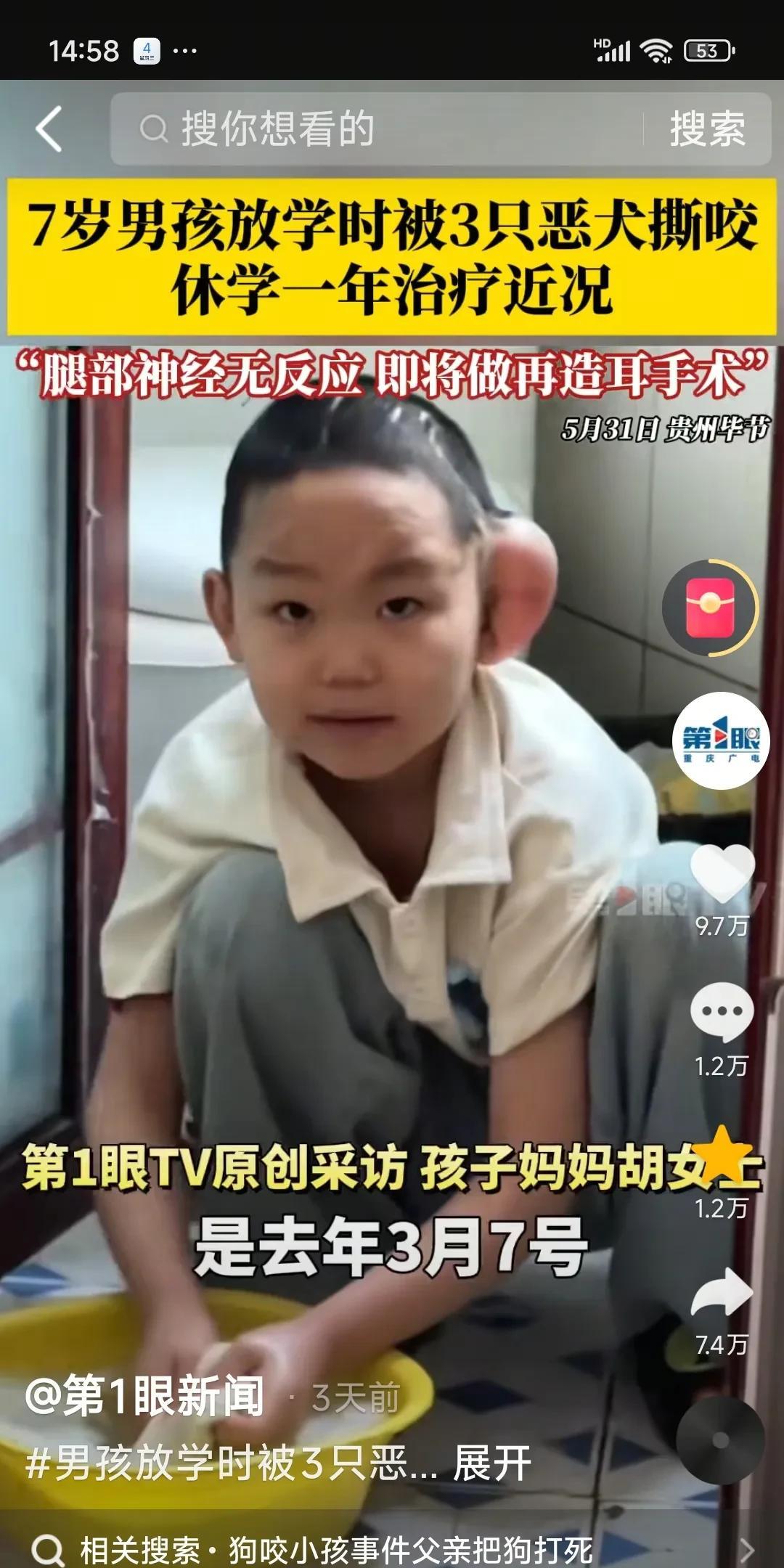 不忍心看啊！这么可爱的孩子，放学路上被三只大狗攻击，咬的血肉模糊，一个耳朵都没
