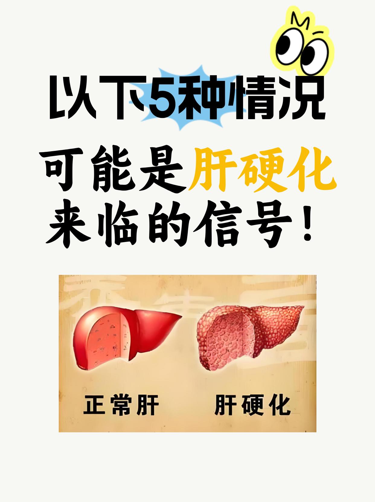 出现以下5种情况，可能是肝硬化来临的信号!治疗肝病40多年，我发现很多肝硬化患