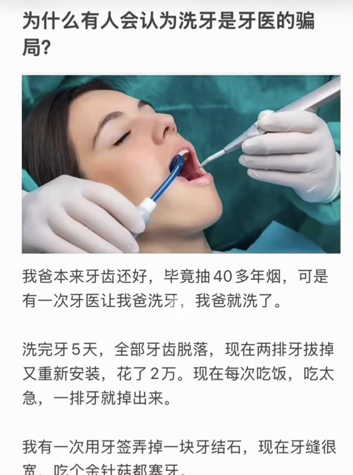 到底该不该洗牙？