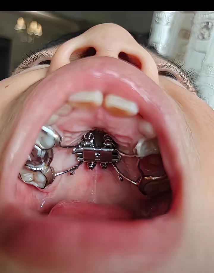 这是干嘛这能受得了么？看着都可怕。😖