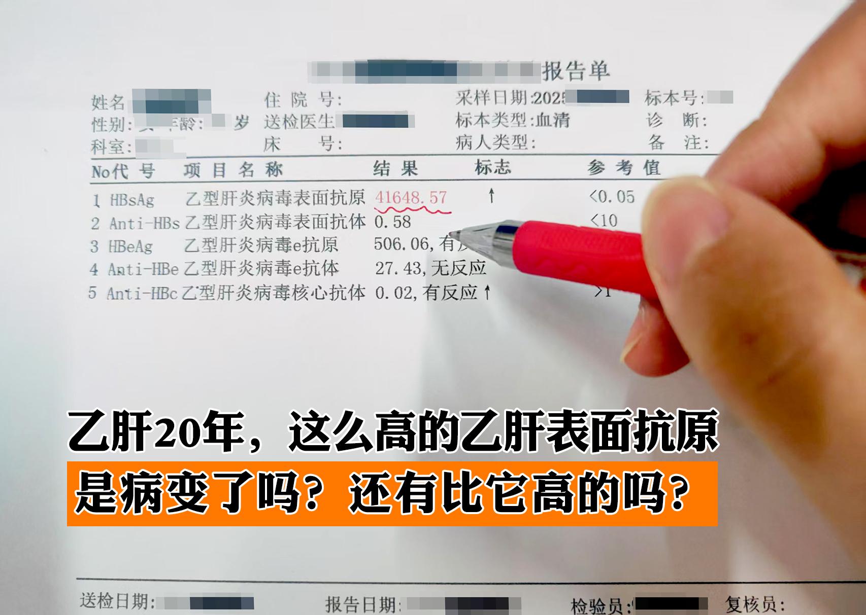 前段时间接诊了一位大三阳患者，乙肝20多年，3年前开始抗病毒治疗，这次...