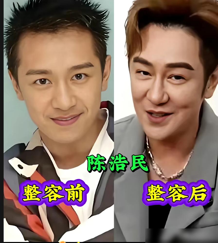 别再吹胡歌了，你看看苏有朋。当年发誓“打死不整容”的五阿哥，现在脸肿得像发面馒头
