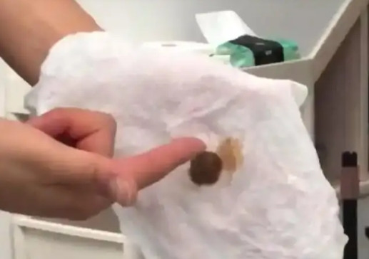 浙江杭州，粪水管接错自来水管引发污水，杭州多个街道小区的业主发帖称，自己家中的自
