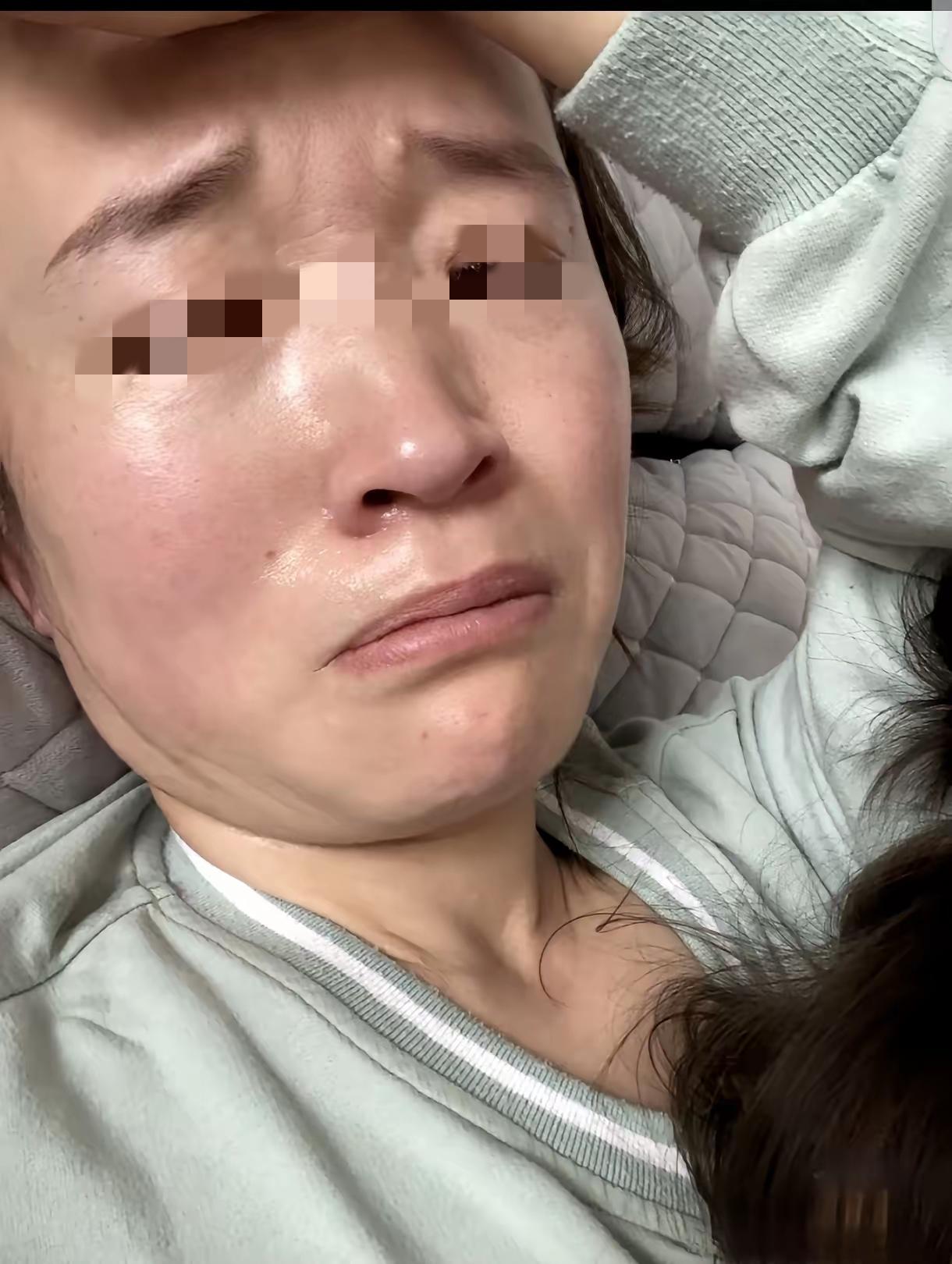 真是愁死了！我妹75年的，今年刚满52岁。年前还能跳广场舞能打麻将，可过完年整