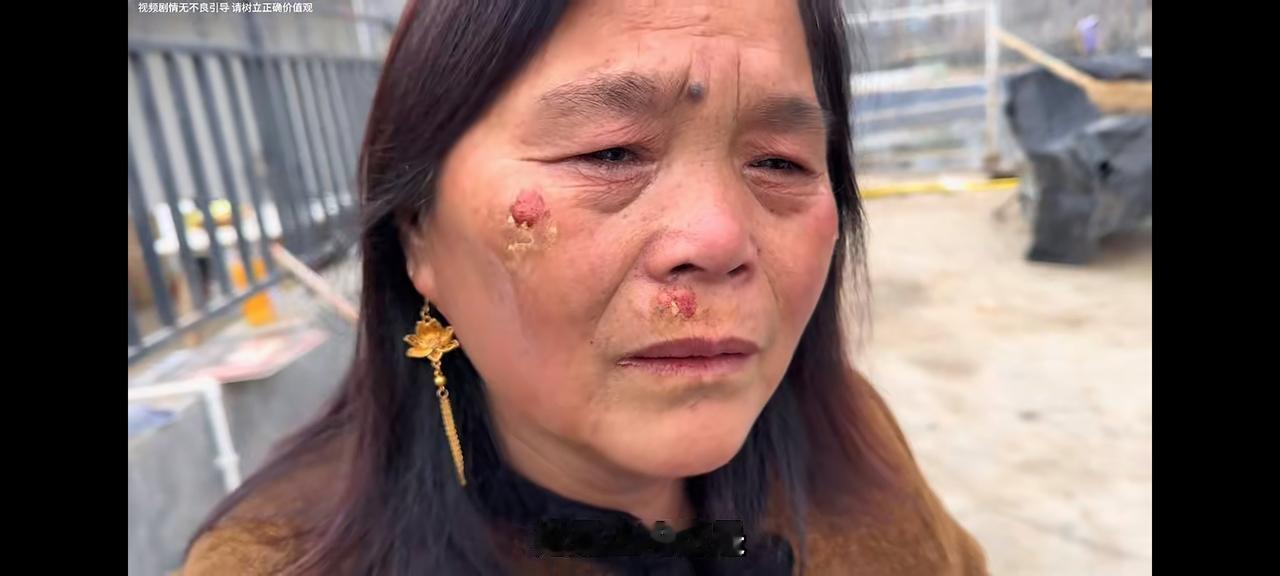 老壳子出车祸了老壳子被车撞伤后，拖着创坏的二轮电动车，和伤痕累累的脸像个花脸猫