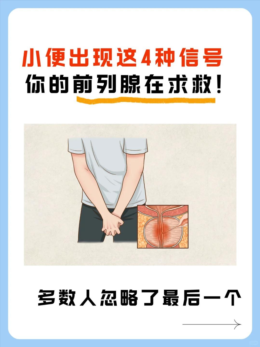 小便出现这4种信号，你的前列腺在求救！