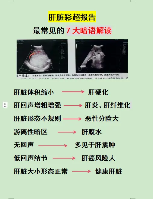肝脏彩超 乙肝 肝硬化 肝炎 肝病教授陈士俊