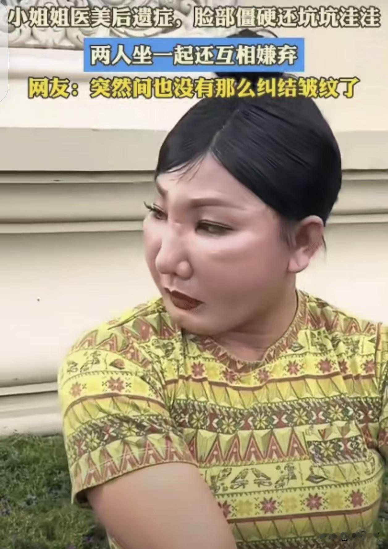 互相鄙视！美女小姐姐医美后，产生后遗症！两人偶然相遇互相在一起鄙视！黄衣服美女