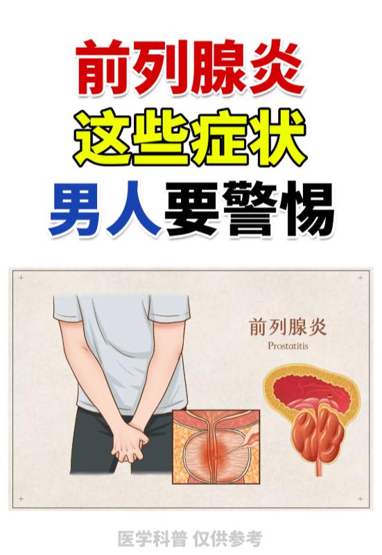 前列腺出现这些异常，男性要多加警惕