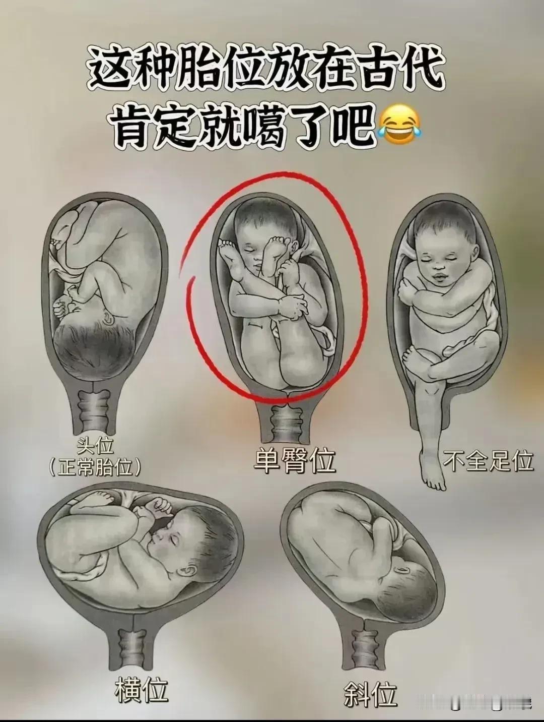 万万没有想到，胎位居然还分那么多种，白瞎我看了十几年，现在才知道！[捂脸哭][捂脸