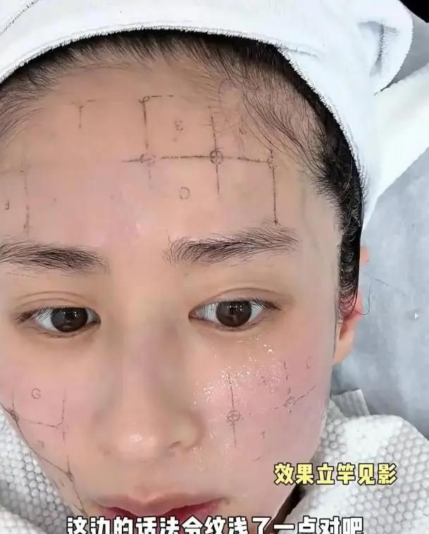7月8日，颖儿在社交平台分享医美过程，为7月进组拍戏，她选择做热玛吉和水光针提拉
