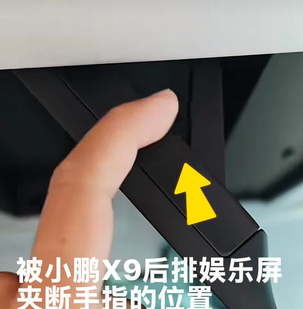 聊一聊：小鹏X9后排娱乐屏，夹断小孩手指的事。据报道的事情的经过：陈