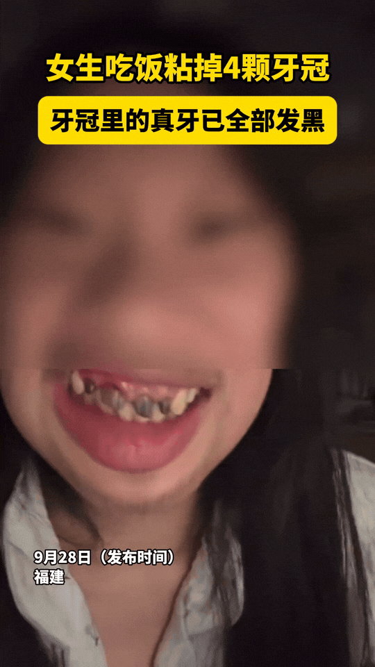 “这下悲剧了！”福建一女生吃饭时，突然感觉门牙一阵清凉，她急忙将嘴里的食物吐出来