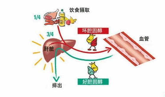 发现高血脂怎么办? 一定要吃药吗?