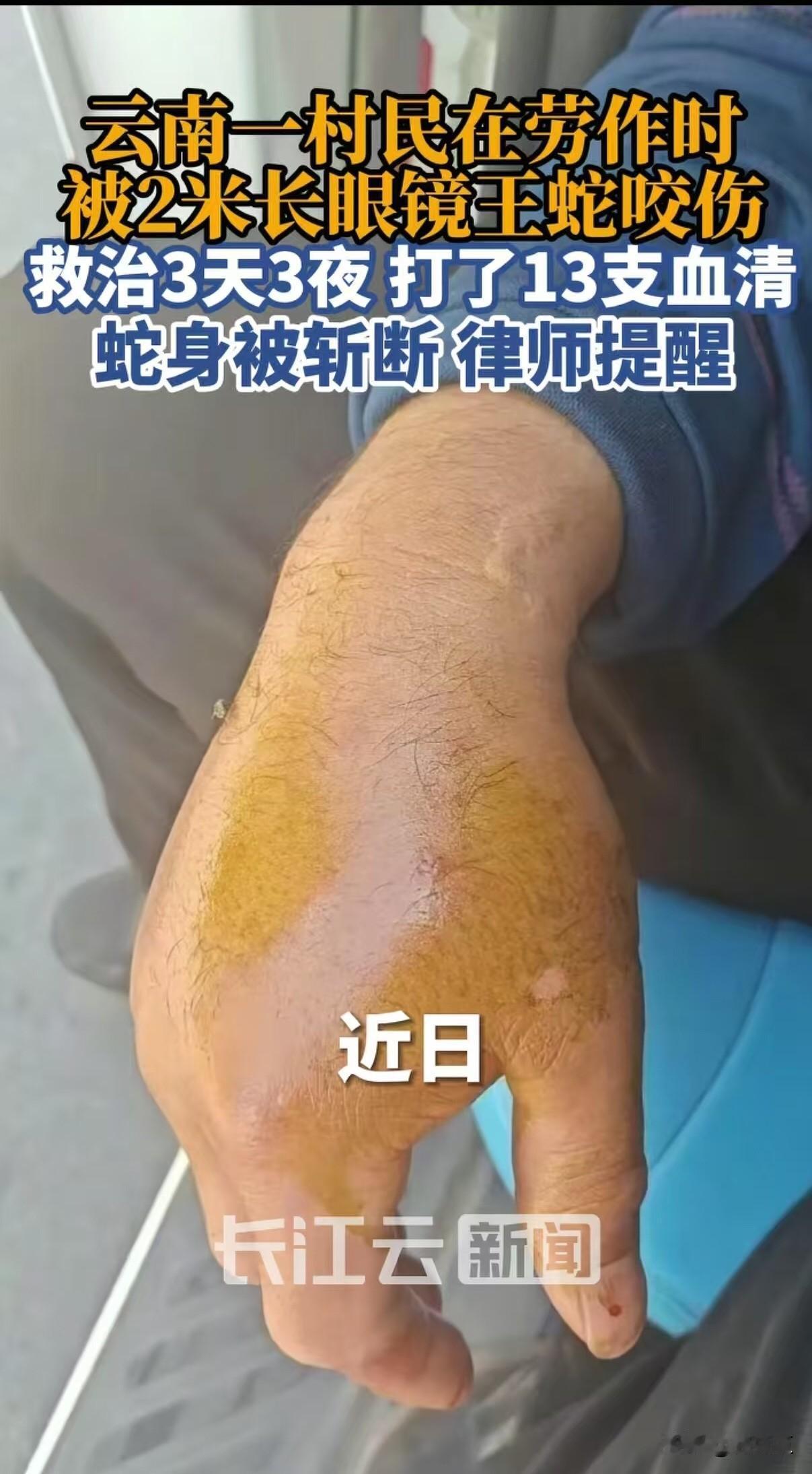 太惊险了！云南一男子在地里干活，突然窜出一条两米多长的眼镜王蛇，又粗又凶，看着都