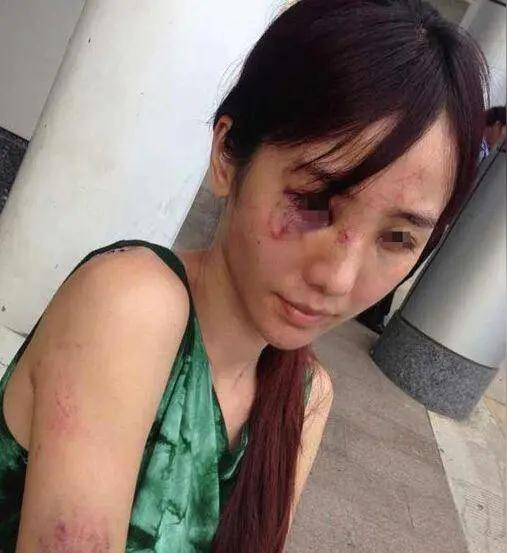 女子被家暴多年，丈夫一喝酒就动手。她哭着去找老中医，对方没开药、没针灸，只教了她