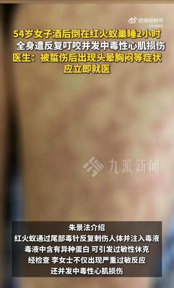 “醉酒女子被红火蚁捡尸！”7月15日报道，福建泉州，一名女子深夜喝得酩酊大醉，整