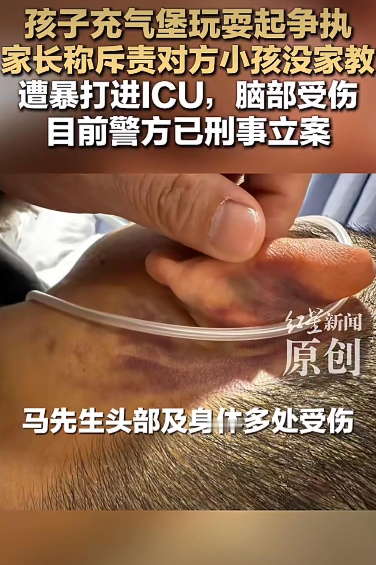 贵州俩小孩在玩耍时起了摩擦，一位家长看着自家孩子受委屈，一时没忍住，冲着对方小孩