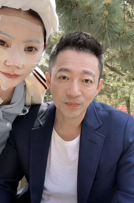 镜头里，他人在威海出镜，眼睛还是鼓鼓的，双眼皮大眼睛完全变了样子。他说是麦粒