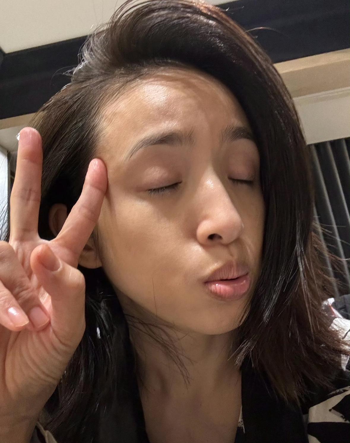 林依晨罕秀纯素颜无修怼脸照，面容憔悴，皮肤暗黄，休产假的妈妈疲惫感藏不住。林依