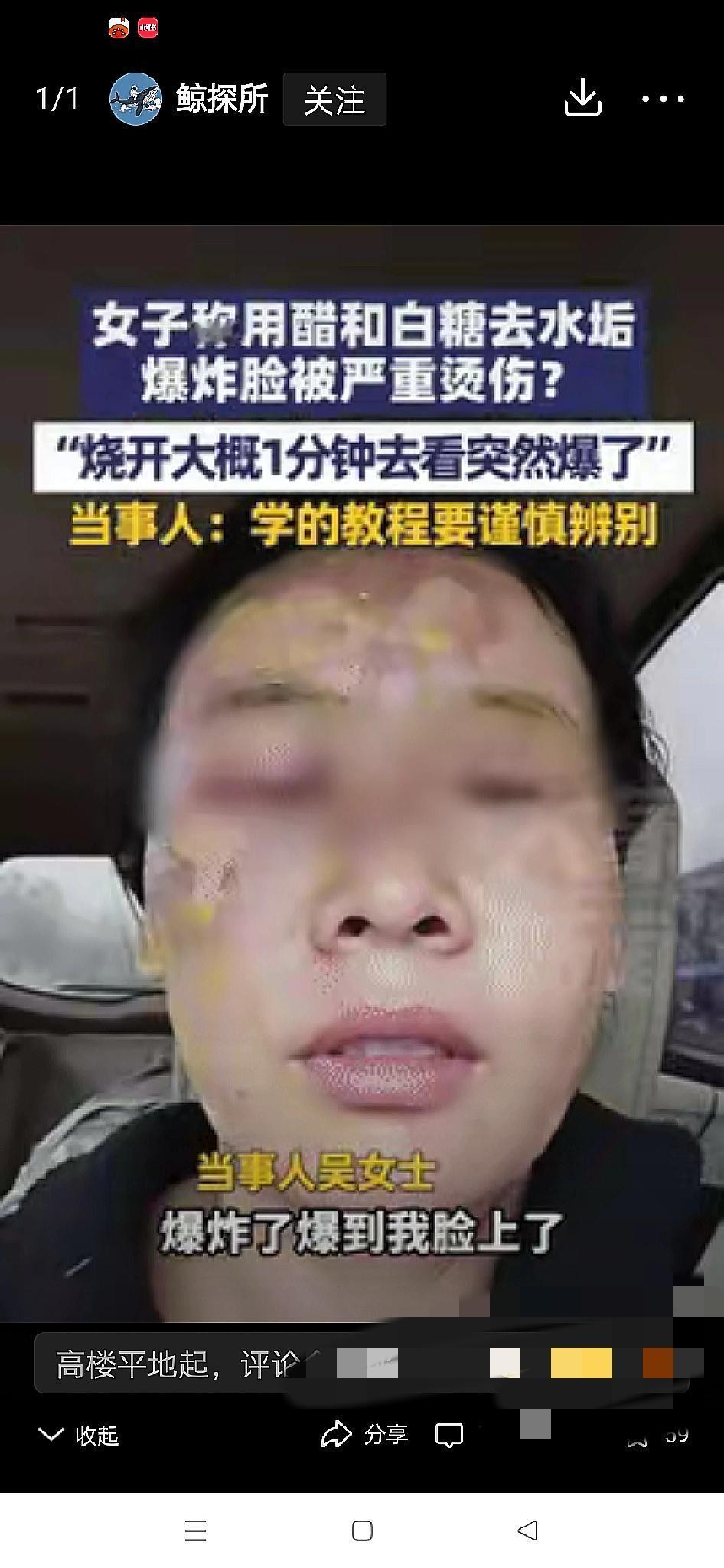 这下真的悲剧了！邯郸一位女子学网上的“除垢妙招”，把白糖+醋倒进刚烧开的热水